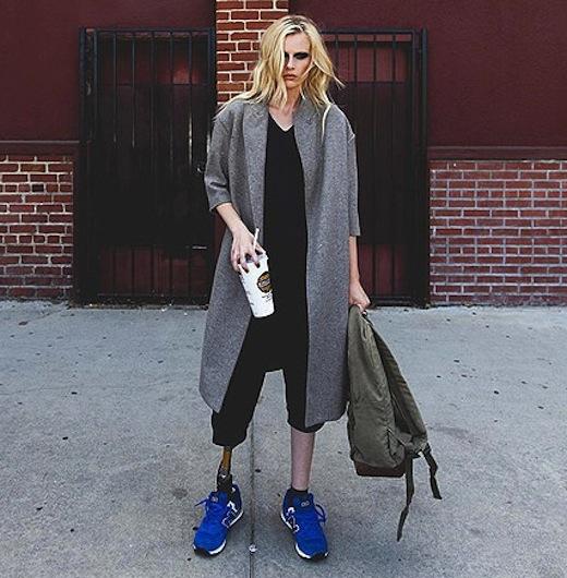 Model Lauren Wasser Loses Both Legs to Toxic Shock Syndrome