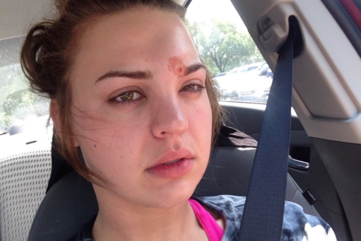 Girl Who Didn't Wash Her Makeup Brushes Almost Died